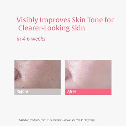 Nutralessece 10% Niacinamide, 4% Tranexamic Acid Serum for Dark Spots, Brightening & Even Skin Tone – Alpha Arbutin & Multi-Hyaluronic Acid Hydrating Essence, for All Skin Types, 1.0 fl oz - Thumbnail 4