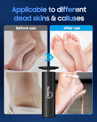 HayZBao Electric Foot Callus Remover - Electric Callus Remover for Feet,Foot Scrubber with 60 Pcs Sandpaper Discs,Professional Pedicure Tool for Dead Skin - Black - Thumbnail 5
