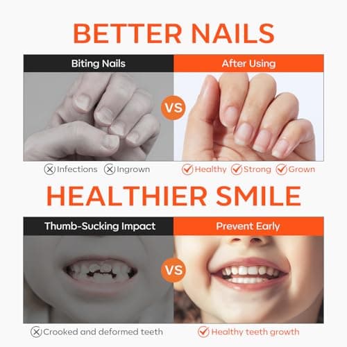 modelones Nail Biting Prevention for Kids 2 Pcs Quick Dry Thumb Sucking Deterrent Bitter Stop Nail Biting Pen No Bite Nail Polish Sets 0.58 Fl Oz - Thumbnail 3