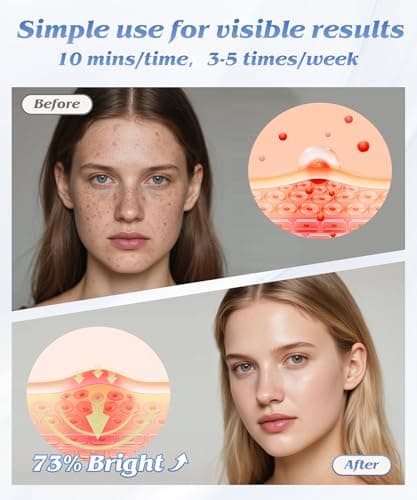EVFOFO Red Light Therapy for Face, Light Therapy Mask for Firming, Wrinkles & Acne, Wireless Red & 850nm Infrared Light Silicone Mask, 7-Color LED Face Mask Portable for Use at Home & Travel, Black - Thumbnail 5