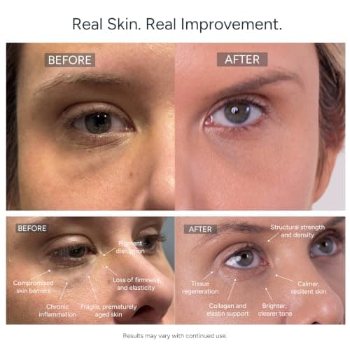 Cellure Tranexamic Acid Peptide Serum – Brightening & Discoloration-Correcting Face Serum with TXA, Peptides & Snow Mushroom, 1.0 fl oz (30 mL) - Thumbnail 5