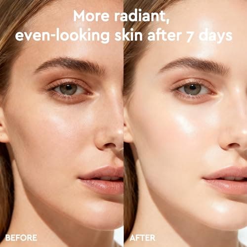 Vitamin C Serum for Face, Anti Aging Dark Spot Remover with Ferulic Acid & Niacinamide, Soothing Brightening Face Serum for Wrinkles and Even Tone, Serum Skin Care Gifts for Women - 30 ml - Thumbnail 6
