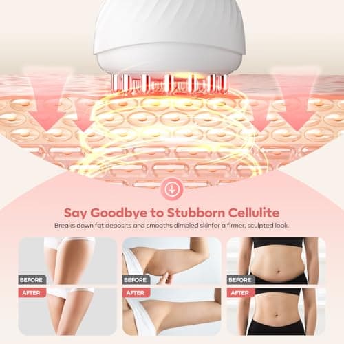 HarrFlow Lymphatic Drainage Massager & Anti Cellulite Massage Tool, Lymphatic Massager,Helps Reduce Stretch Marks & Cellulite，for Belly, Arms & Legs,Body Sculpting Machine with Heat & Vibration - Thumbnail 3