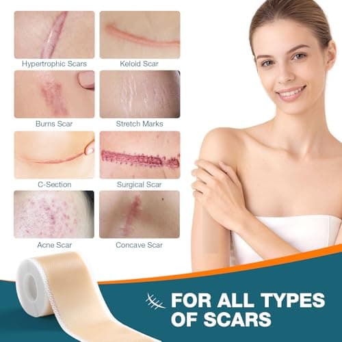 Silicone Scar Sheets,Silicone Scar Tape, Professional Scar Removal, Silicone Scar strips for Surgical scars tape, C-Section,Tummy Tuck (1.6x11859''Roll-3.0M) Keloid bump removal - Thumbnail 2