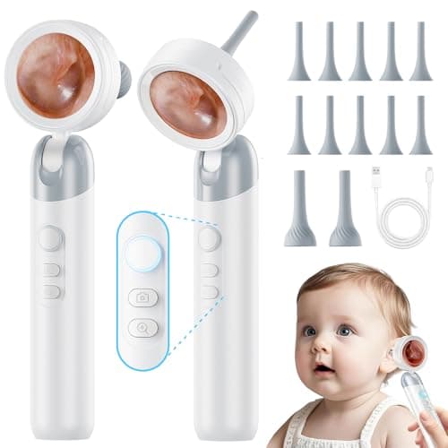Aspoven Otoscope Ear Camera with Light, 1.4” Screen 1080P HD Ear Scope, 12 Silicone Specula Tips, Photo & Video Recording, Type-C Rechargeable, Ear Cleaning Camera for Adult Kid and Pet - Image 1