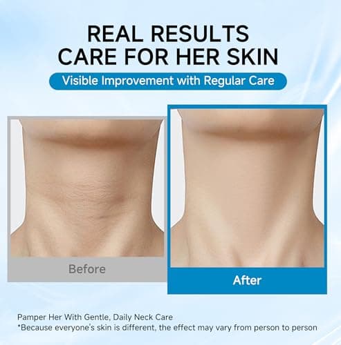 HONLINK 8PCS Collagen Neck Mask Set with Hyaluronic Acid & Peptides, Hydrating Neck Care Masks for Dry & Crepey-Looking Skin, Helps Support the Appearance of Fine Lines | Mother’s Day Gift for Women - Thumbnail 4