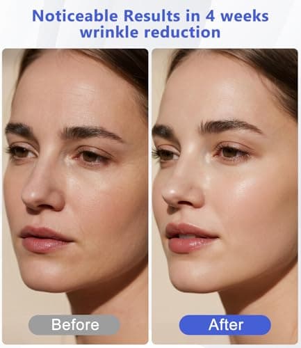 LED Light Therapy Machine FDA Cleared Red, Infrared and Blue Light Therapy, LED Face Mask Light Therapy Skin Care Photon Device for Wrinkle Reduction and Acne, G3 - Thumbnail 2