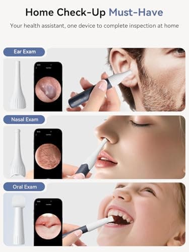 Ear Wax Removal Tool Camera: ZERONDER I35R Ear Cleaner with Flexible Ear Camera Otoscope - Visual Ear Pick Tweezers Wax Remover - Ear Cleaning Kit for Family - Thumbnail 6