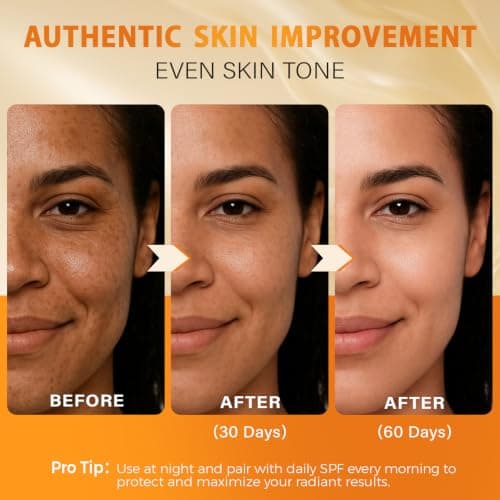 QOOQ Turmeric Kojic Acid Soap for Dark Spots Remover – Facial Cleansing Bar with Vitamin C, Retinol, Collagen, Vitamin E, Glycerin, Shea Butter & Castile Olive Oil – Soap for Women & Men (120g x 2) - Thumbnail 2