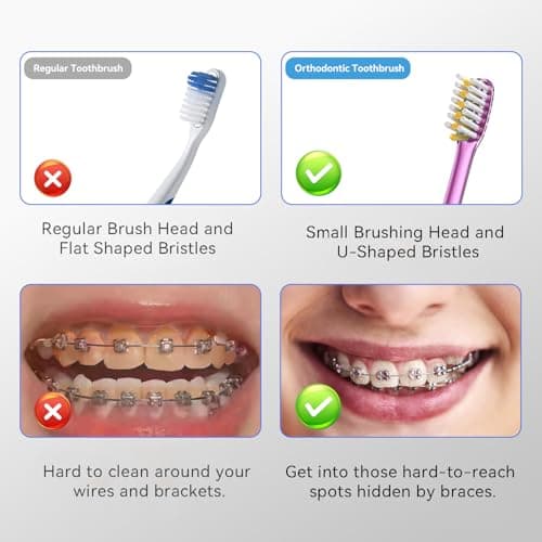 JTF Orthodontic Manual Toothbrush for Braces: 6 U-Shaped Tooth Brush with 6 Interdental Brushes, Ultra-Durable Bristles for Stain Removal and Deep Oral Clean, Toothbrushes for Tooth with Dental Device - Thumbnail 5