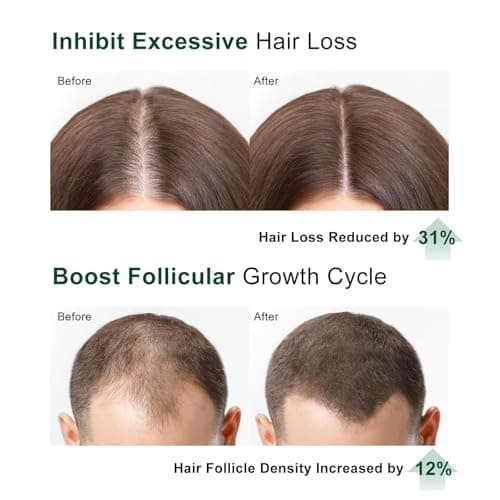 Hair Density Serum, Rosemary Biotin Scalp for Thinning Hair, Peptide Hair Growth Helps Reduce Shedding, Niacinamide and Caffeine Hair Loss Serum, Silicone Scalp Applicator, 2.0 fl oz - Thumbnail 3