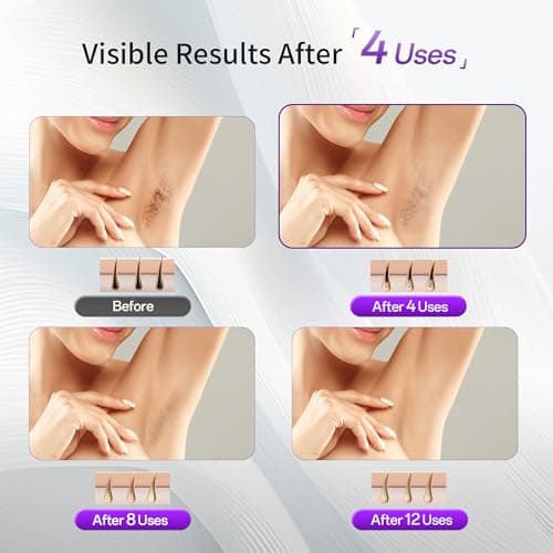 NAISIGOO Laser Hair Removal Device for Women & Men, At-Home Painless IPL Laser Hair Remover with 40°F Ice-Cooling Contact, Long-Lasting Lazer Hair Removal for Face, Legs, Armpits, Bikini Line - Thumbnail 5