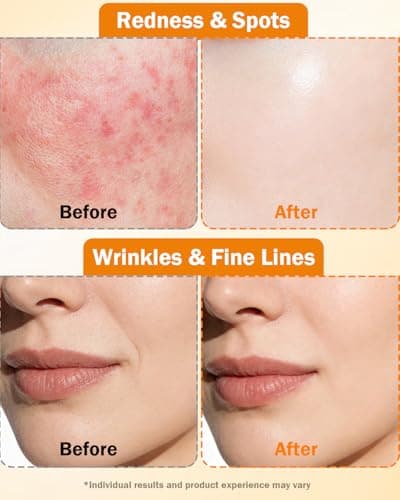 Super Vitamin C Serum for Face | Natural Anti-Aging Formula with Vitamin C, Hyaluronic Acid, Vitamin E & Caffeine - Firming Serum for Hydration, Wrinkle Reduction & Dark Spot Brightening - 1 Fl Oz - Thumbnail 5