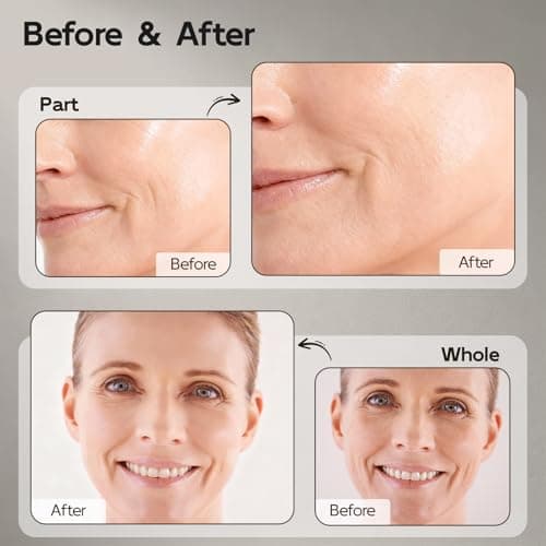Retinol Serum for Face, Anti Aging & Anti Wrinkle B5 Resurfacing Retinol Serum with Niacinamide, Collagen & Hyaluronic Acid, Smooths Wrinkles & Fine Lines, Dark Spot Corrector, Brighten Dullness - Thumbnail 2