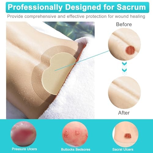Sacrum Silicone Foam Dressing with Gentle Border, Sacrum Wound Bandages, Breathable Waterproof Sacral Dressing for Pressure Ulcers, Sacral Ulcers and Buttocks Bedsores (7" x 7", Pack of 5) - Thumbnail 6