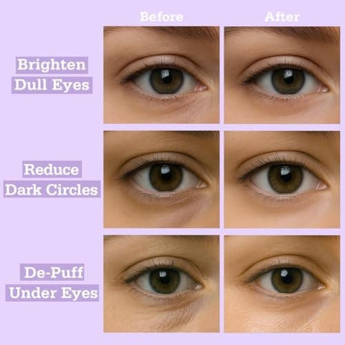 Tintark Lavender Hydrogel Under Eye Patches 28 Pairs 5 Minute Calming Hydrating Eye Mask for Puffy Eyes and Dark Circles Relaxing Cooling Under Eye Pads Ophthalmologist Tested - Thumbnail 6