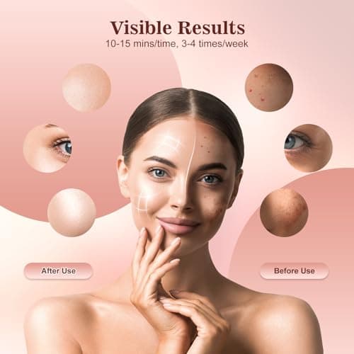 INTEO Red Light Therapy for Face, 3 Modes Portable Led Face Mask Light Therapy with Remote, Infrared Light Mask with Timing Function, Led Light Therapy At Home - Thumbnail 3