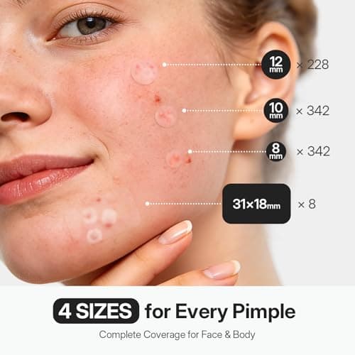 ZATKTK Pimple Patches for Face, 920 Count Hydrocolloid Acne Patches with Salicylic Acid, Bulk Pimple Stickers for Zit Breakouts and Blemishes, 4 Sizes, Fast Absorbing Spot Patch - Thumbnail 5