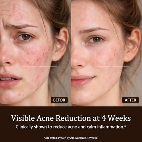 SUBRUN Red Light Therapy for Face, FDA-Cleared Red Light Therapy Mask, 336 LEDs Full Face Coverage & 4 Modes, Rechargeable Cordless At-Home Facial Skincare Device, Birthday Gifts for Women Mom Wife - Thumbnail 4