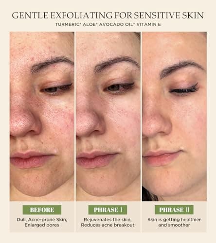 Revitalizing Exfoliation Face Scrub with Vitamin C and Turmeric – Gentle Exfoliating Face Wash for Blackheads, Pore Dirt & Dark Spots –Daily Balancing Facial Scrub for All Skin Types, 4.23 Fl Oz - Thumbnail 4