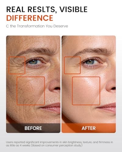 Super C Serum for Mature Skin – All-in-One Vitamin C Serum for Face with Retinol & Hyaluronic Acid for Women Over 60 & 70 – Anti-Aging Hydrating Serum for Dark Spots, Wrinkles & Fine Lines 1.0 fl.oz. - Thumbnail 5