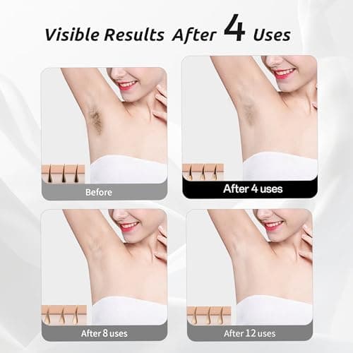 NAISIGOO Laser Hair Removal Device for Women and Men, IPL Painless Sapphire with 40F Ice-Cooling System, Safe, Long-Lasting Hair Removal for Home, Face, Legs, Back, Bikini Line - Thumbnail 4