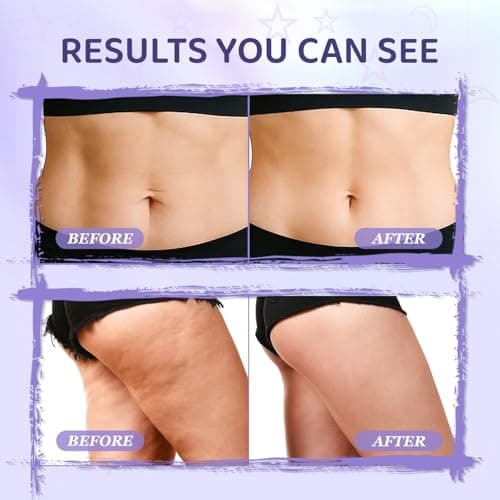 MYTH-Dreamy Overnight Toning Whip Firming Cellulite Cream, Skin Firming and Tightening Lotion While You Sleep - Helps Tighten Loose Skin & Cellulite on Body Belly Booty Arms Thighs with Gua Sha Tool - Thumbnail 4