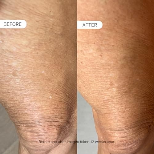 oneskin BODY OS-01 Peptide Topical Supplement & Skin Longevity Age Reversal Moisturizer | Safe for Sensitive Skin, Fragrance-Free, 250 mL / 8.45 oz - Thumbnail 4