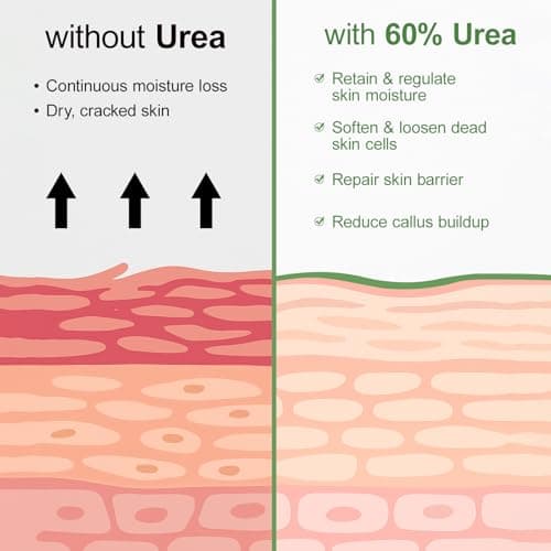 YAFUSIPE Urea Cream 60 Percent For Feet Maximum Strength Plus Salicylic Acid 2%, Tea Tree Foot Lotion For Dry Feet, Foot Cream Intensive Repair Foot Moisturizer 5.29oz - Thumbnail 6