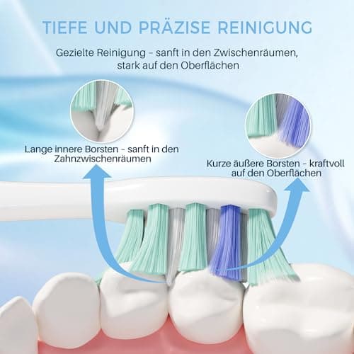 PERECT Soft Replacement Toothbrush Heads 12-Pack for Philips Sonicare Click-On Models – Fits 4100, 5100, 6100, 9023, W Optimal Plaque Control, Not Compatible with Essence/E-Series or Philips One - Thumbnail 2