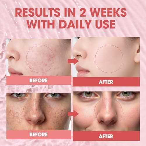 Pink Peptide 12 PDRN Serum – Salmon DNA 10,320ppm, 12 Peptides + Niacinamide for Hydrating, Firming & Glowing Skin – 30ml / 1.01 fl.oz. - Thumbnail 3