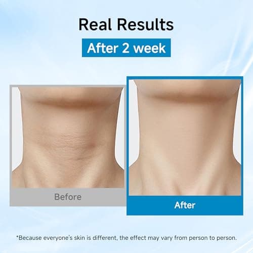 Neck Mask 8PCS, HONLINK Hydrolyzed Collagen Neck Mask Set with Hyaluronic Acid & Peptide,Moisturizing Firming Masks for Crepey Skin, Helps Reduce the Appearance of Fine Lines for Smoother-Looking Skin - Thumbnail 4