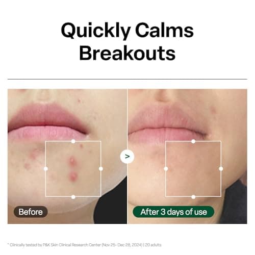 Dr. G R.E.D. Blemish Clear Hyal-Cica Soothing Serum - Korean Skincare - Long-Lasting, Hydrating Serum for All Skin Types - Cools Skin Temperature - Hyaluronic Acid & Centella Asiatica - 1.69 fl oz - Thumbnail 6