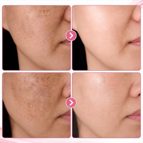Neatique Arbutin 8% + Tranexamic Acid 5% Face Cream, Dark Spot Corrector with Niacinamide & Glutathione, Lightweight Moisturizer for Uneven Tone & Post-Blemish Marks, 2 fl oz/60 ml - Thumbnail 6