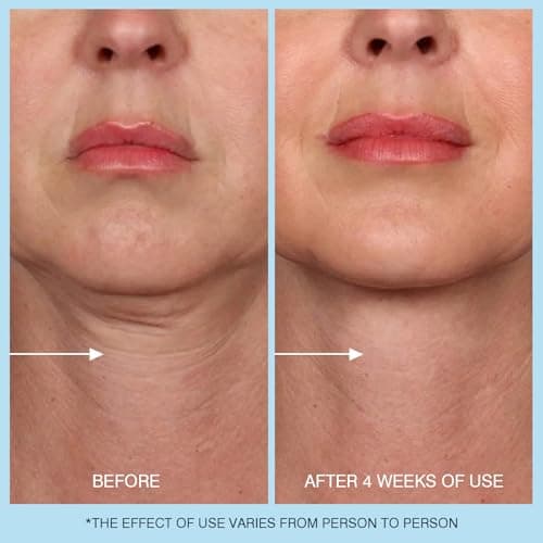 UJhay Retinol Neck Cream, Hyaluronic Acid and Caffeine Enriched Neck Firming Cream to Minimize Fine Lines & Dullness - 3-in-1 Moisturizing Cream for Neck, Chest and Face (50 ml/1.7 oz) - Thumbnail 6