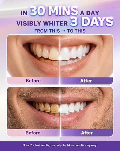 Purple Teeth Whitening Strips, Purple Whitening Strips Color Correcting for Sensitive Tooth, Enamel Safe, Non-Slip, Removes Yellow Stains, 30 Min Fast Whitening, 6 Treatments (12 Strips, Mint) - Thumbnail 2