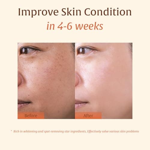Turmeric Kojic Acid Soap – Hand-made Soap, Cold Process, Dark Spot Remover for Face & Body, Skin Brightening, Even Tone, By Vitamin C, Retinol, Vitamin E, Shea Butter & Hyaluronic Acid – 2 Bars - Thumbnail 4