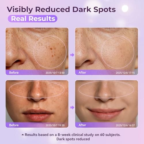 LGUYO Dark Spot Remover for Face & Body - Effective Remedy for Dark Spots & Dark Spot Corrector Cream for Age Spot, Freckles, Melasma, Sun Spot - Even Toning Skin Care for Women and Men - 1.7 Fl Oz - Thumbnail 4