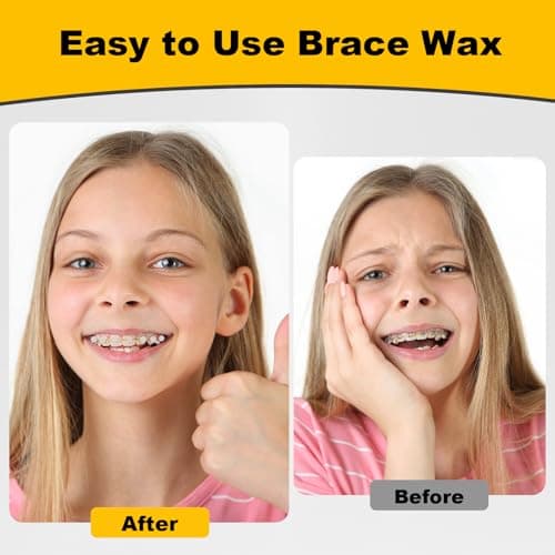 ACSKD 180PCS Braces Wax,Orthodontic Wax with Individual Packaging,Dental Waxs for Brace Travel Home Office,Strawberry - Thumbnail 4
