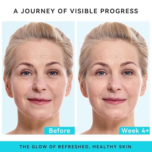 XIANUI Retinol Face Cream with Collagen & Hyaluronic Acid - Anti Aging & Firming Face Moisturizer for Women & Men - Wrinkle Reduction Night & Day Cream, 1.7 Fl Oz - Thumbnail 2