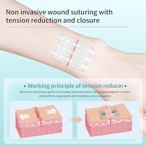 Wound Closure Strips Zip Stitch Sutures Butterfly Bandaids Emergency Laceration Closure Kit for Lacerations Incisions Cuts(6X8CM) - Thumbnail 5