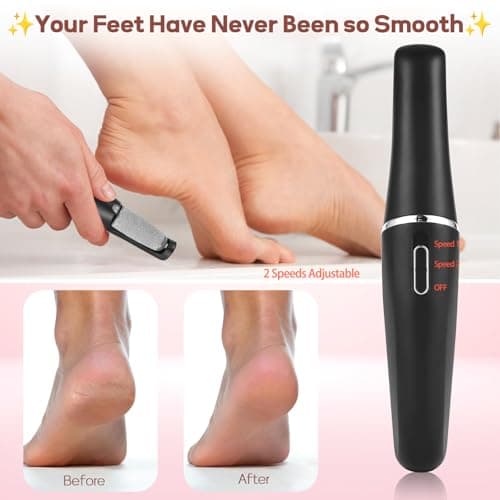 Electric Foot Callus Remover, Callus Remover for Feet Rechargeable Portable Pedicure Tools, Foot Grinder Smooth Pedicure Wand for Feet Care, Removes Dry Hard & Dead Skin Ideal Gift -Black - Thumbnail 3