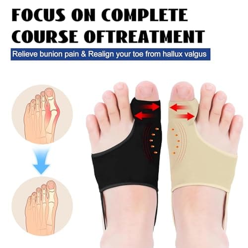 Hvshq 2PCS Bunion Corrector for Women & Men, Comfortable Big Toe Straightener with Pads & Splint, Hallux Valgus Pain Relief for Day & Night Support with Anti-slip Strap(Black,1 Pair) - Thumbnail 3