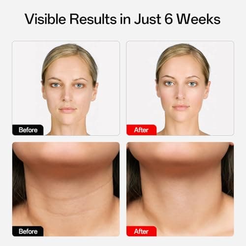 Facego Red Light Mask for Face and Neck, 7 Colors Red Light Face Mask with Rechargeable Remote Controller, Flexible, Portable, Lightweight, and Ergonomic for Home & Travel (White) - Thumbnail 4