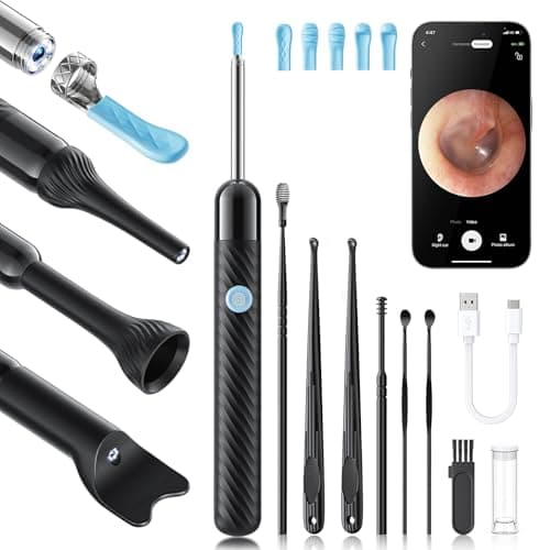 Loyker X6 Ear Wax Removal Tool Camera, Ear Cleaner with Camera, FSA - HSA Store Eligible, 1080P Ear Camera with 6LED Light for Ear/Nose/Throat/Tonsil Stone Examination, Black - Image 1