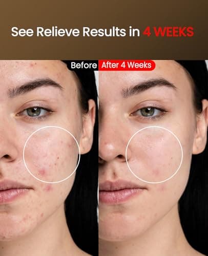 Facego Red Light Mask for Face, 7+1 Colors Red Light Face Mask, Cordless Red-Light Facial Mask Non-Skin Contact, Rechargeable Skincare at Home & Travel - Thumbnail 4