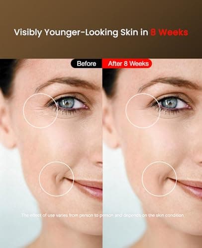Facego Red Light Mask for Face, 7+1 Colors Red Light Face Mask, Cordless Red-Light Facial Mask Non-Skin Contact, Rechargeable Skincare at Home & Travel - Thumbnail 3