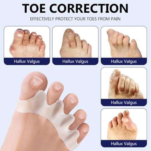 XINIFOOT Toe Separators for Women & Men - Bunion Corrector, Hammer Toe Straightener, Relieves Foot Pain (2 Pairs, White + Beige) - Thumbnail 5