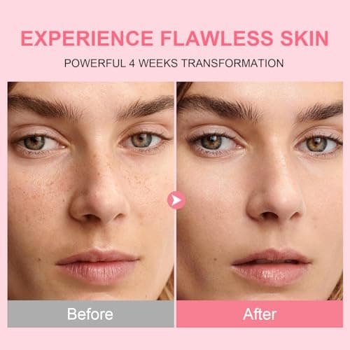 AVJONE PDRN Serum for Face – with 10% Niacinamide & Collagen, Advanced Facial Serum for Uneven Skin, Hydration & Elasticity, Glass Skin, Fragrance Free, 30ml,1.01 fl.oz - Thumbnail 6