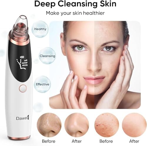 Blackhead Remover Pore Vacuum for Face and Nose, Facial Pore Cleanser with 3 Suction Levels, 5 Replaceable Tips, USB Rechargeable Tool for Blackheads and Whiteheads（White） - Thumbnail 2